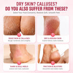 Silicone Foot Care Socks