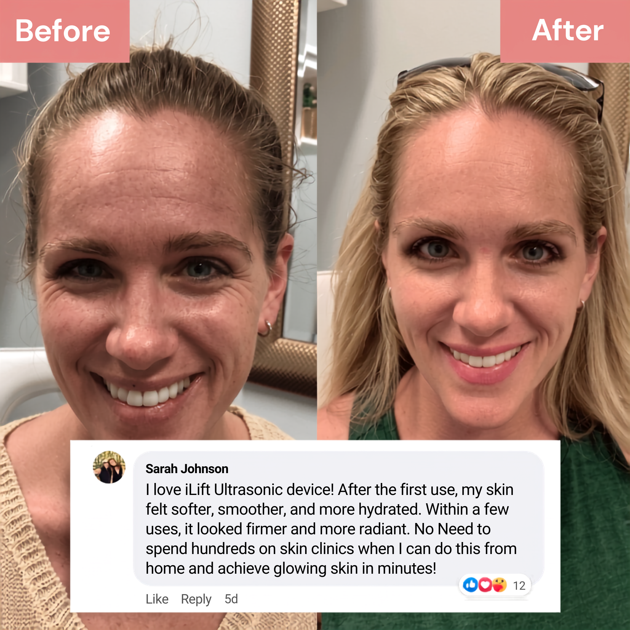 The Glow Signature Dual-Frequency Ultrasound Skincare Device